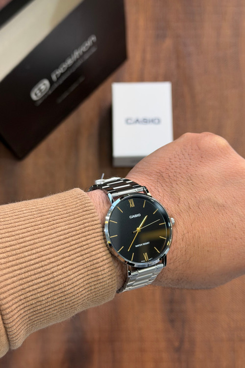 نمای روی دست